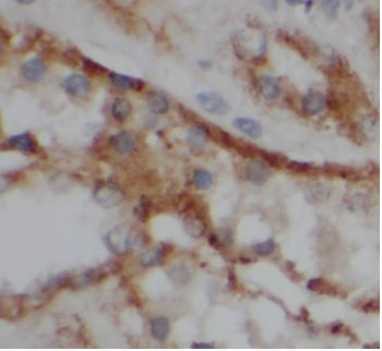 VIPR1 Rabbit Polyclonal Antibody