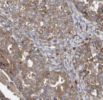 NAMPT Rabbit Polyclonal Antibody