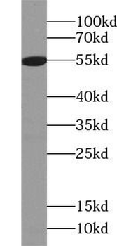 vitamin D binding protein Rabbit Polyclonal Antibody