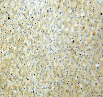 vitamin D binding protein Rabbit Polyclonal Antibody