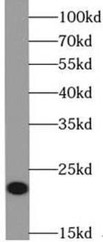 VMO1 Rabbit Polyclonal Antibody