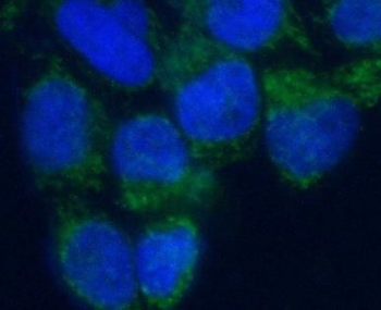 VMO1 Rabbit Polyclonal Antibody