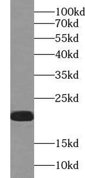 VPS25 Rabbit Polyclonal Antibody