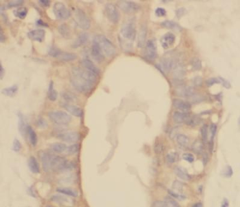 VPS25 Rabbit Polyclonal Antibody