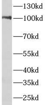 PIK3C3 Rabbit Polyclonal Antibody