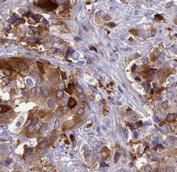 PIK3C3 Rabbit Polyclonal Antibody