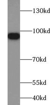 VPS35 Rabbit Polyclonal Antibody