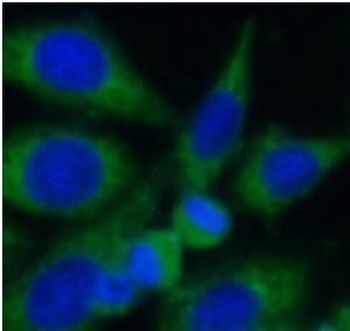 VPS35 Rabbit Polyclonal Antibody