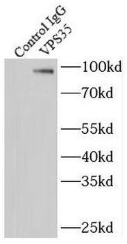 VPS35 Rabbit Polyclonal Antibody