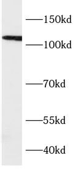 VPS39 Rabbit Polyclonal Antibody