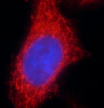 VPS45 Rabbit Polyclonal Antibody