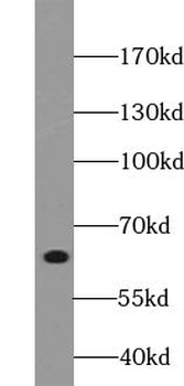 VPS45 Rabbit Polyclonal Antibody