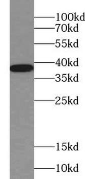 VTA1 Rabbit Polyclonal Antibody