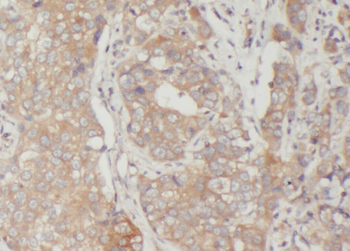 VTCN1 Rabbit Polyclonal Antibody