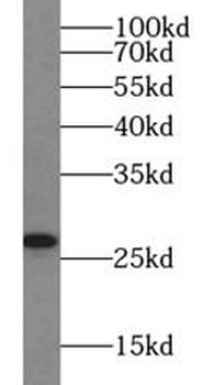 VTI1B Rabbit Polyclonal Antibody