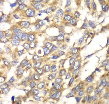 VTI1B Rabbit Polyclonal Antibody