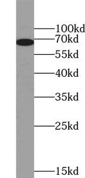 GALNT17 Rabbit Polyclonal Antibody