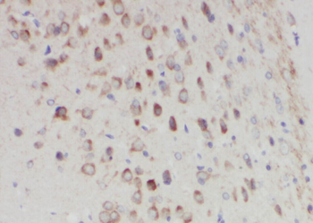 GALNT17 Rabbit Polyclonal Antibody