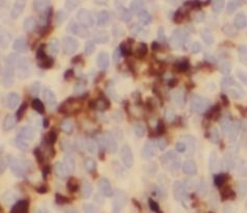 WDFY4 Rabbit Polyclonal Antibody
