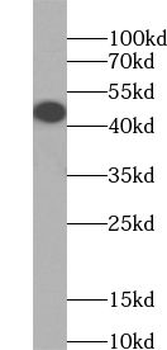 CCN4 Rabbit Polyclonal Antibody