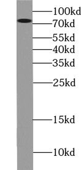 WRAP53 Rabbit Polyclonal Antibody