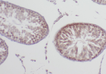 WRAP53 Rabbit Polyclonal Antibody