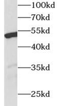 WT1 Rabbit Polyclonal Antibody