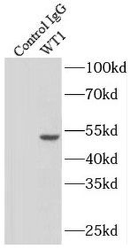WT1 Rabbit Polyclonal Antibody