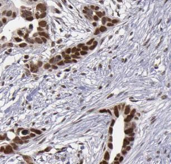 WT1 Rabbit Polyclonal Antibody
