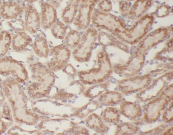 AMER1 Rabbit Polyclonal Antibody