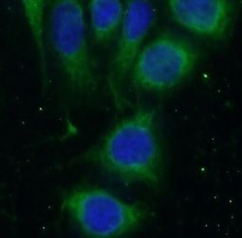 WWP1 Rabbit Polyclonal Antibody