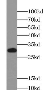 XBP1 Rabbit Polyclonal Antibody