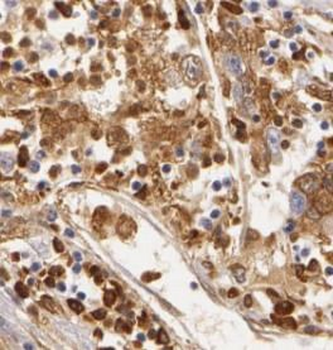 XBP1 Rabbit Polyclonal Antibody