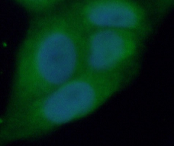 XIAP Rabbit Polyclonal Antibody