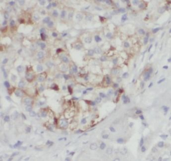 XIAP Rabbit Polyclonal Antibody