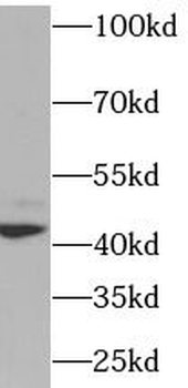 XRCC4 Rabbit Polyclonal Antibody