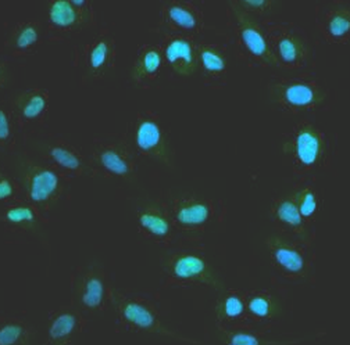 XRCC4 Rabbit Polyclonal Antibody