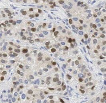 XRCC4 Rabbit Polyclonal Antibody