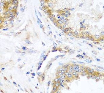 YBX1 Rabbit Polyclonal Antibody