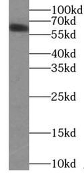 YTHDF1 Rabbit Polyclonal Antibody