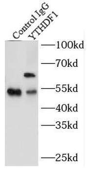 YTHDF1 Rabbit Polyclonal Antibody