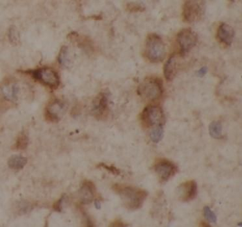 YTHDF1 Rabbit Polyclonal Antibody