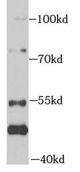 MAP3K20 Rabbit Polyclonal Antibody