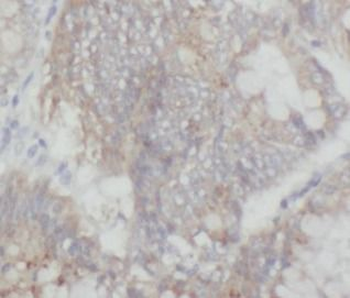 MAP3K20 Rabbit Polyclonal Antibody