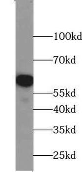 ZBTB22 Rabbit Polyclonal Antibody