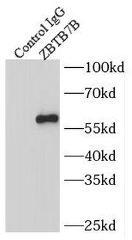 ZBTB7B Rabbit Polyclonal Antibody