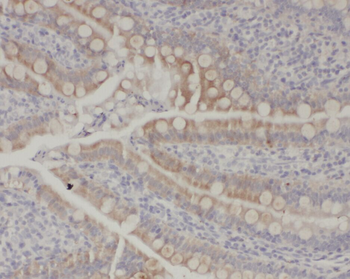 ZC3H12A Rabbit Polyclonal Antibody