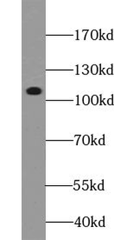 ZC3H7B Rabbit Polyclonal Antibody