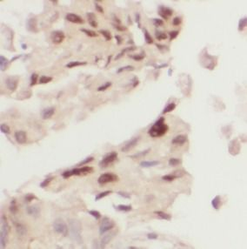 ZEB1 Rabbit Polyclonal Antibody