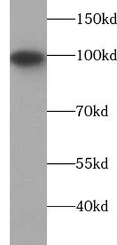 ZHX2 Rabbit Polyclonal Antibody